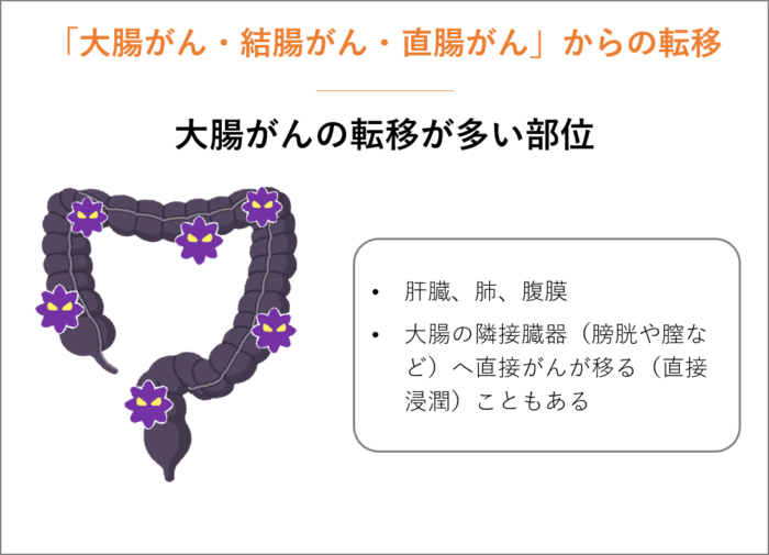 「大腸がん・結腸がん・直腸がん」からの転移