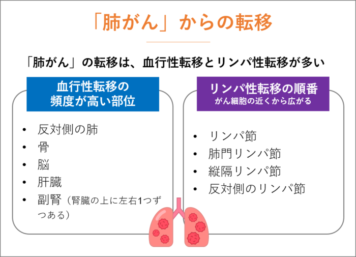 「肺がん」からの転移