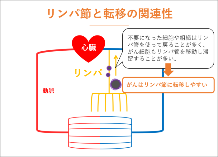 リンパ節と転移の関連性