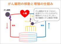 癌が転移してもあきらめない。転移癌が治る確率とその可能性
