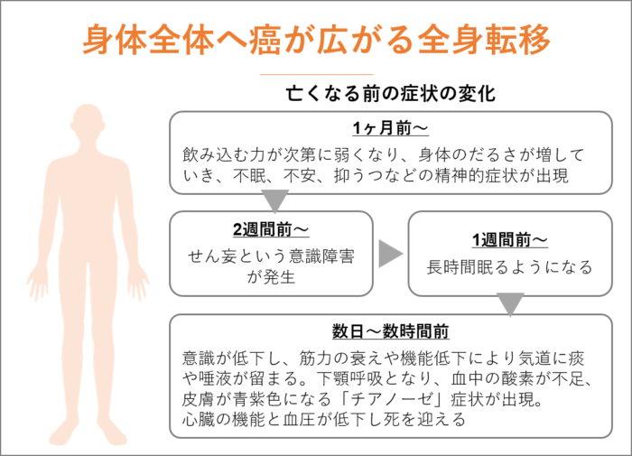 身体全体へ癌が広がる全身転移