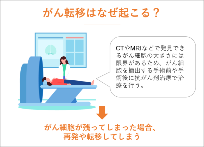 がん転移はなぜ起こる？原因と背景