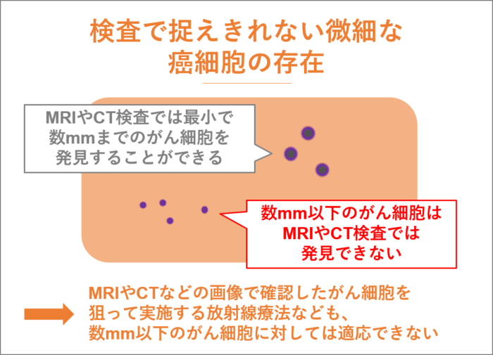 検査で捉えきれない微細な癌細胞の存在