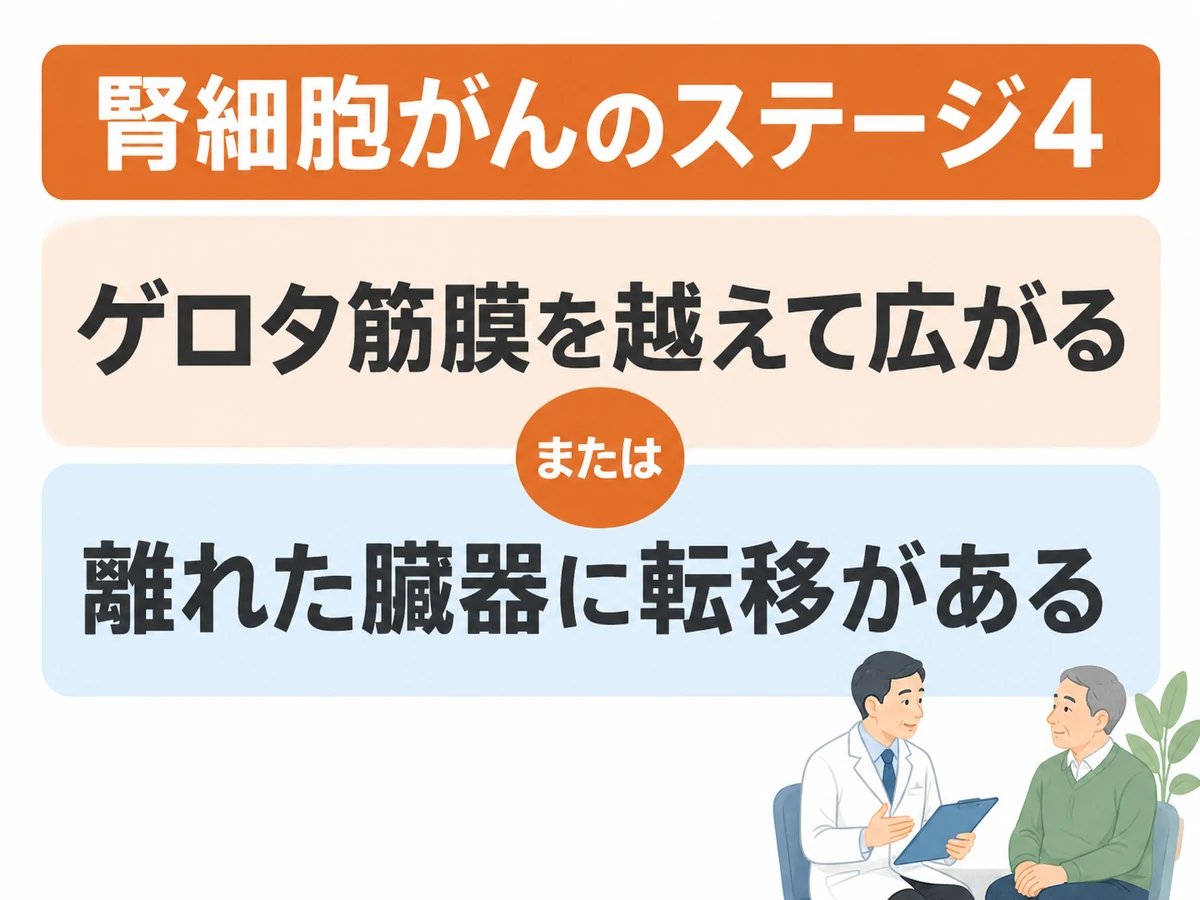 腎細胞がんのステージ4は、ゲロタ筋膜を越えた広がり、または離れた臓器への転移がある状態であることを示す図解。