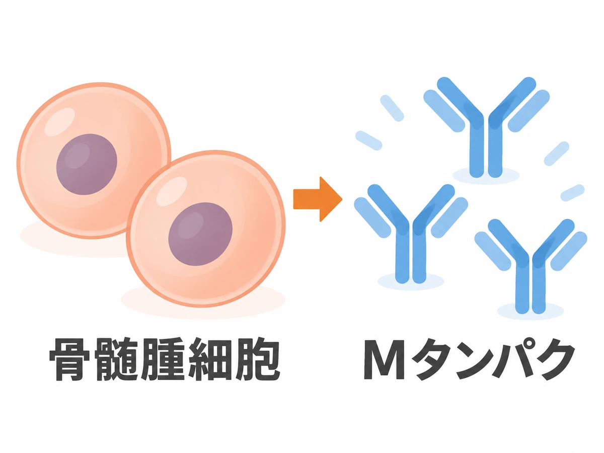 骨髄腫細胞からMタンパクがつくられる関係を示した簡潔な図解