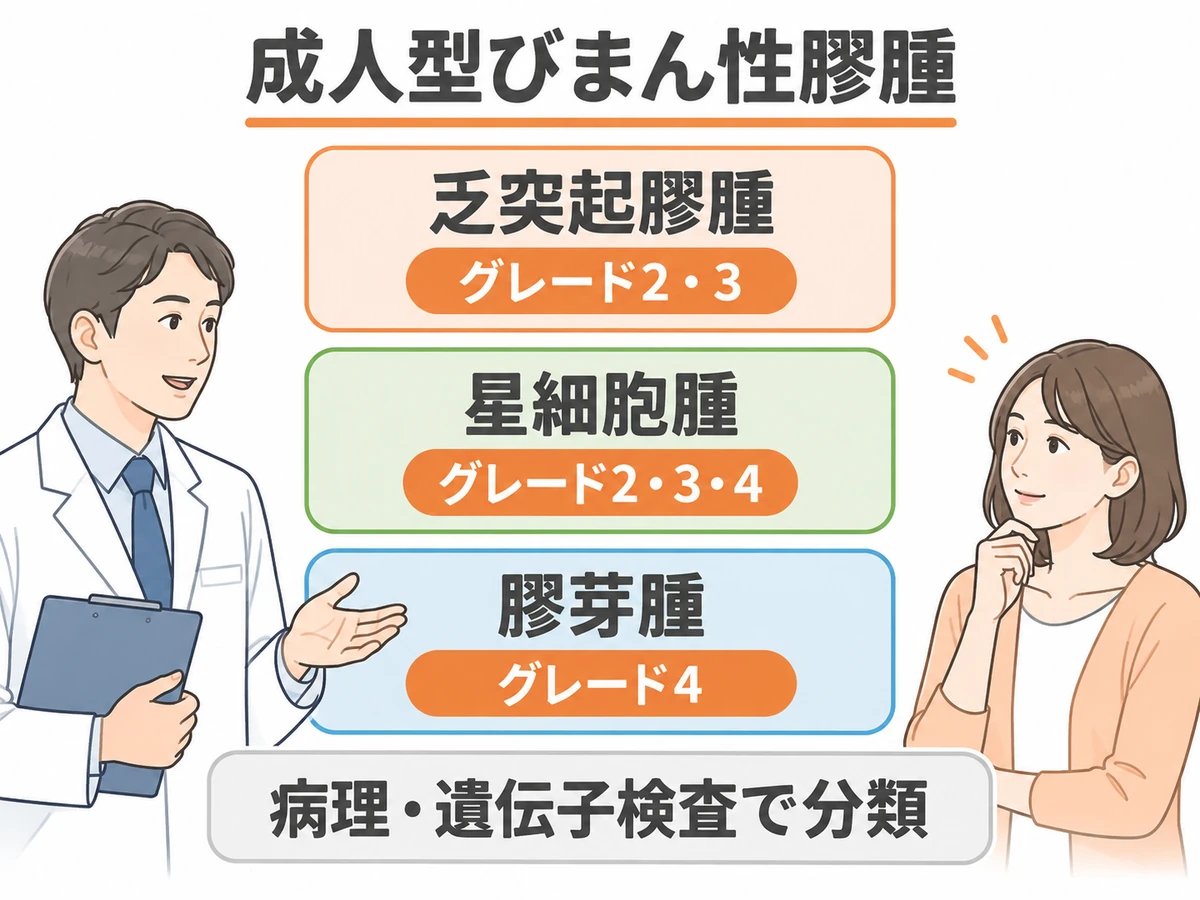 成人型びまん性膠腫の乏突起膠腫・星細胞腫・膠芽腫のグレードと、病理・遺伝子検査で分類することを示す図解