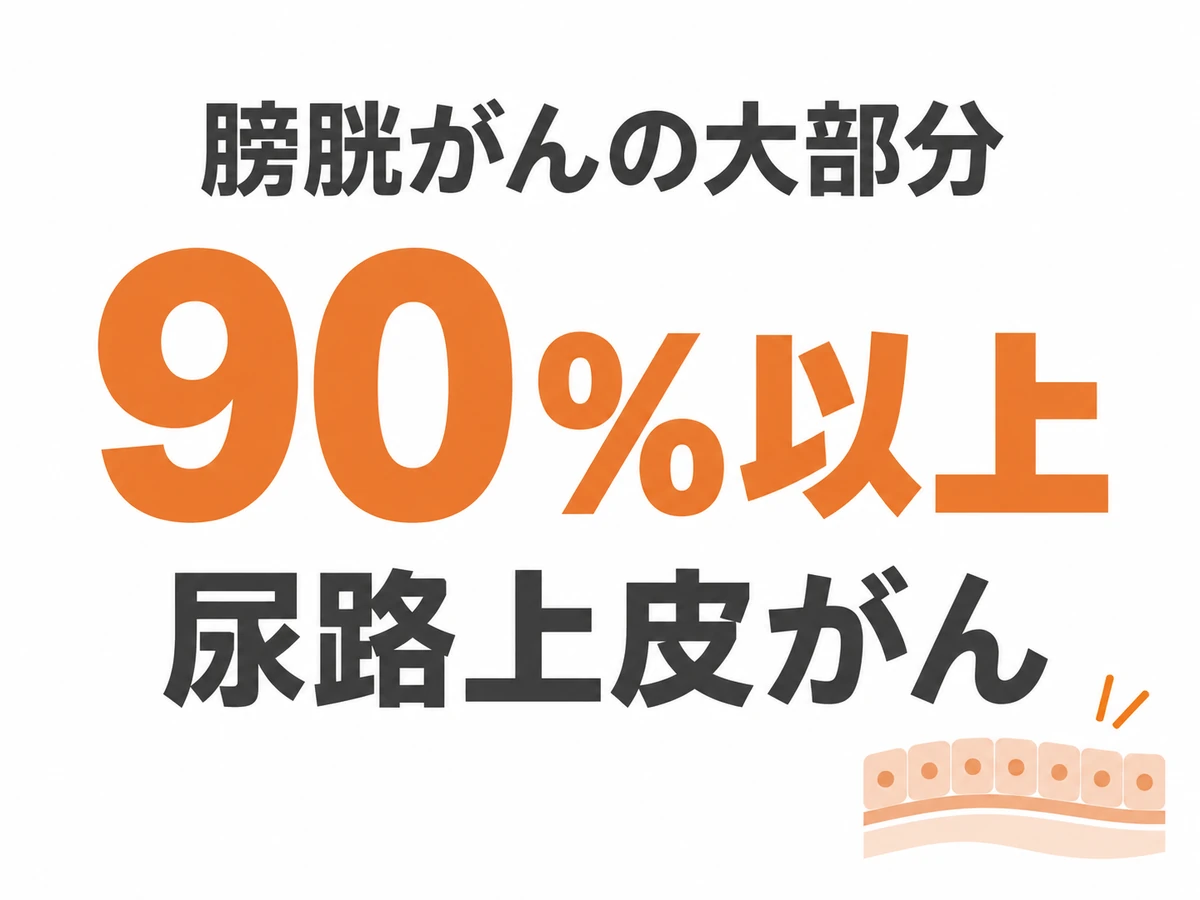 膀胱がんの大部分、90%以上が尿路上皮がんであることを大きな文字で示した図解。