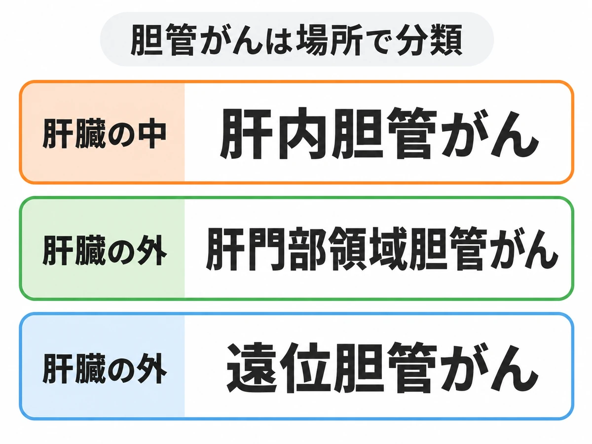 胆管がんを発生場所により肝内胆管がん、肝門部領域胆管がん、遠位胆管がんに分けた図