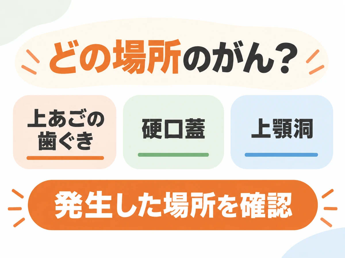 上あごの歯ぐき、硬口蓋、上顎洞のうち、がんが発生した場所を確認するための図