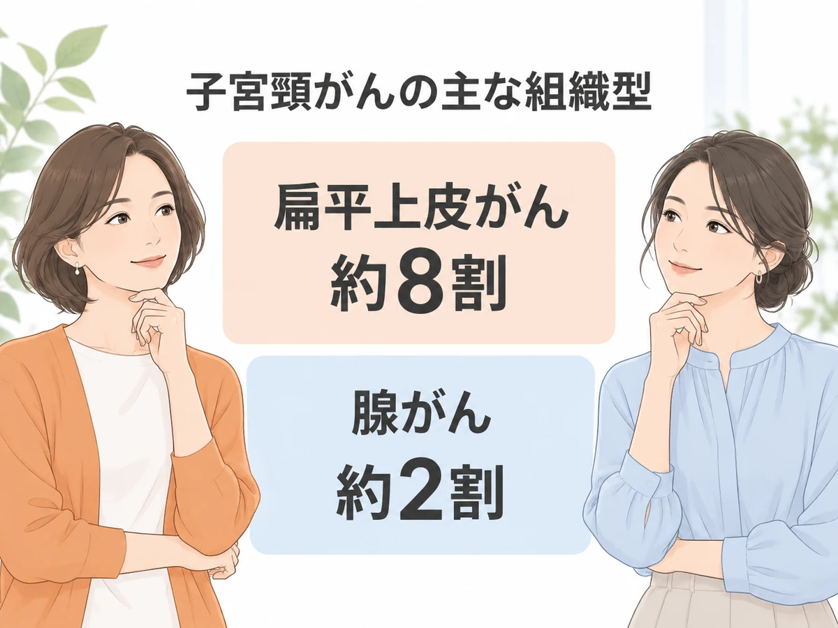 子宮頸がんの主な組織型として扁平上皮がん約8割、腺がん約2割を示す図解。