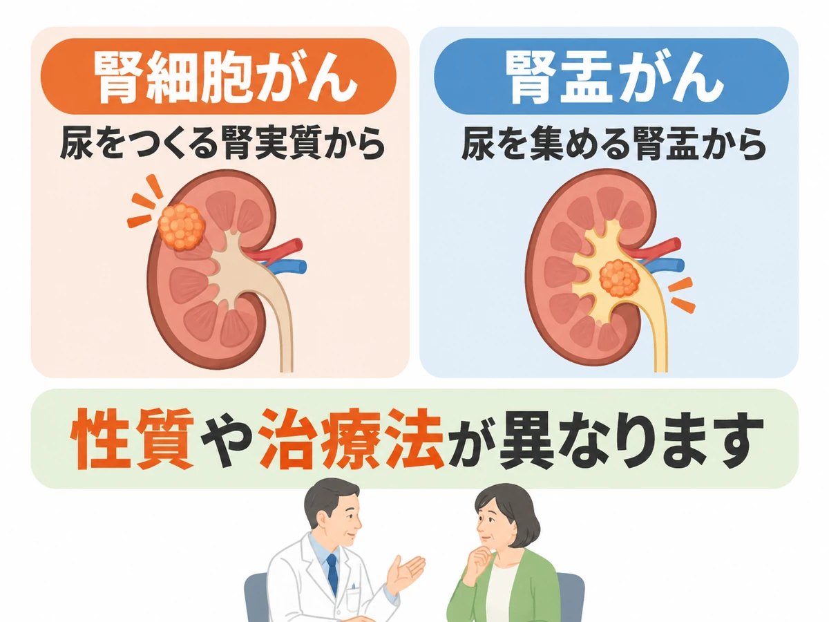 腎細胞がんは尿をつくる腎実質から、腎盂がんは尿を集める腎盂から発生し、性質や治療法が異なることを比較するイラスト。