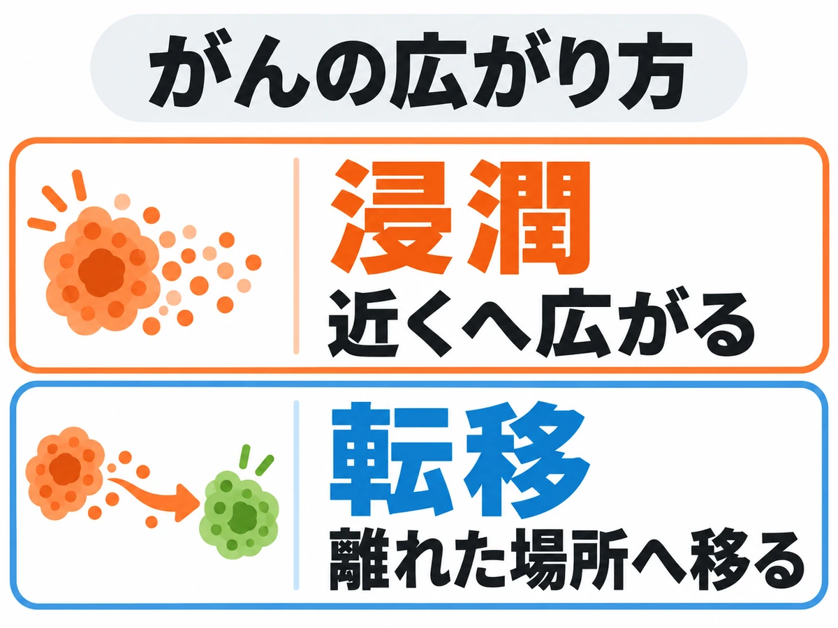 浸潤は近くへ広がること、転移は離れた場所へ移ることを対比した概念図