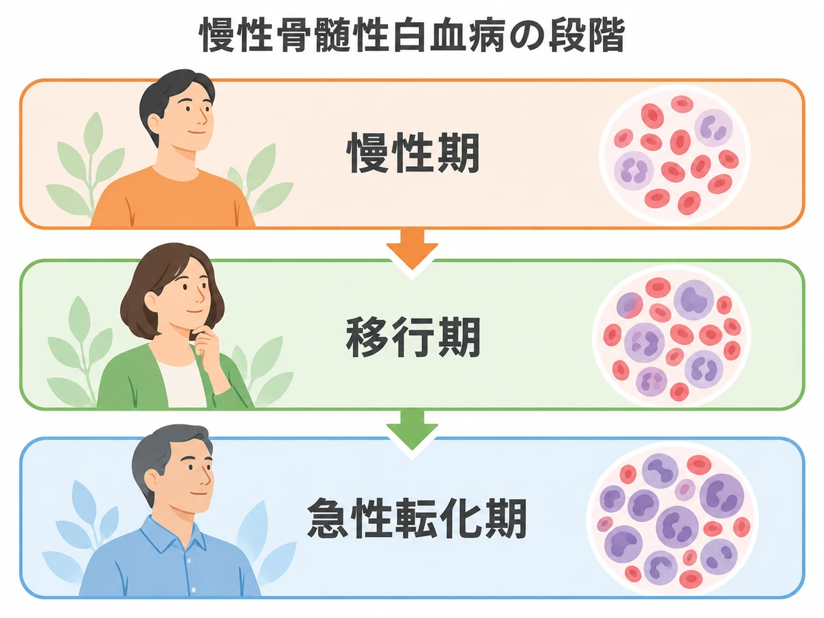 慢性骨髄性白血病の慢性期、移行期、急性転化期を示す図解