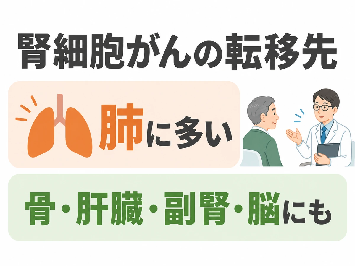 腎細胞がんは肺に転移が多く、骨・肝臓・副腎・脳にも転移することを示すイラスト。