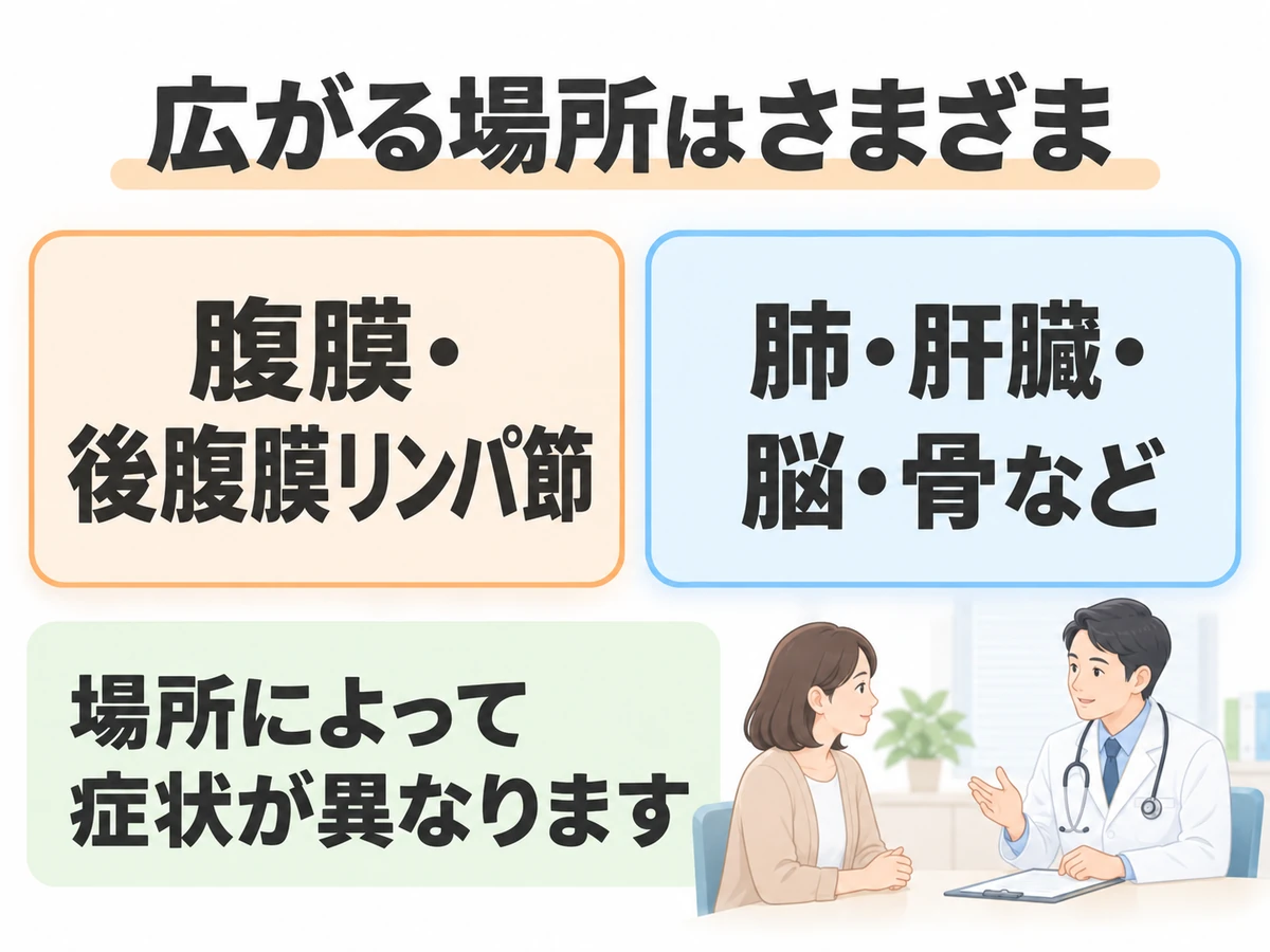 腹膜・後腹膜リンパ節と肺・肝臓・脳・骨など、広がる場所によって症状が異なることを示す図。