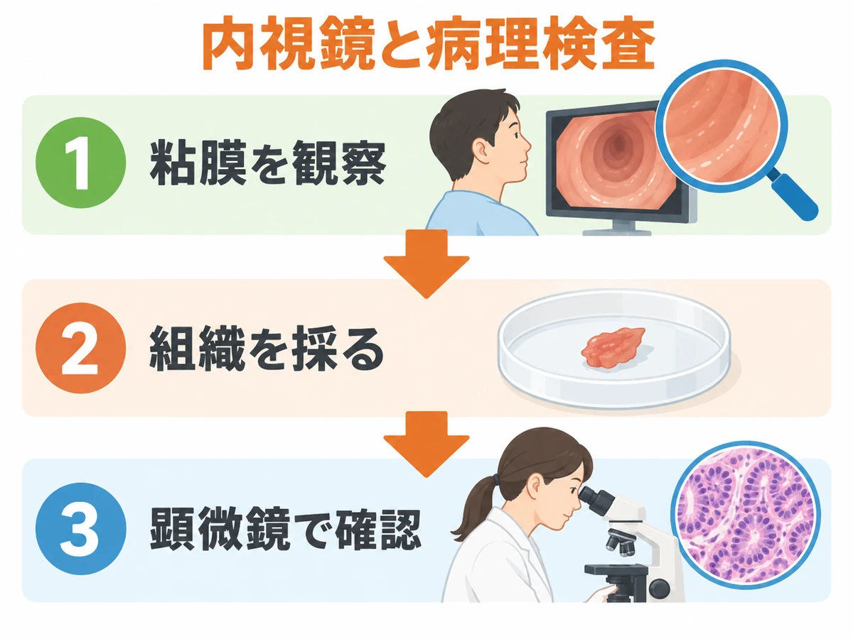 内視鏡で粘膜を観察し、組織を採って顕微鏡で確認する流れを示す図解