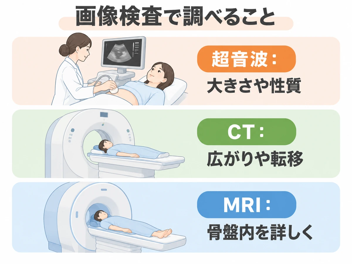 超音波で大きさや性質、CTで広がりや転移、MRIで骨盤内を詳しく調べる役割を示す図。