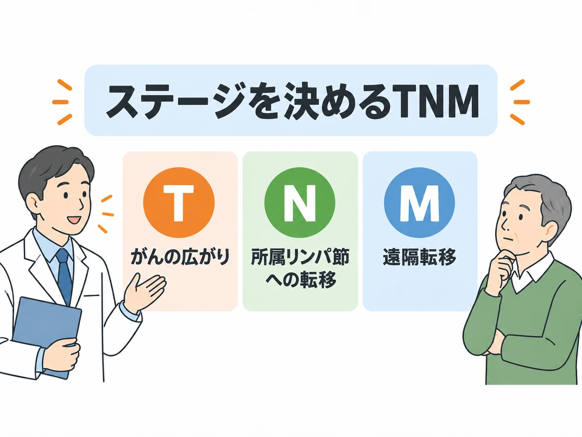 病期を決めるTNM分類のTはがんの広がり、Nは所属リンパ節への転移、Mは遠隔転移と示す図解