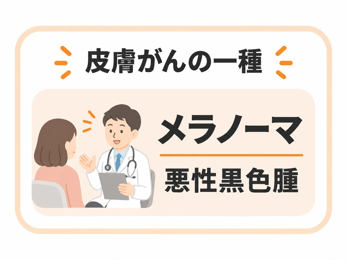 メラノーマは悪性黒色腫で皮膚がんの一種であることを、医師と患者の挿絵とともに示す図。